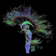 Illustration for article titled How Did Brains Evolve?